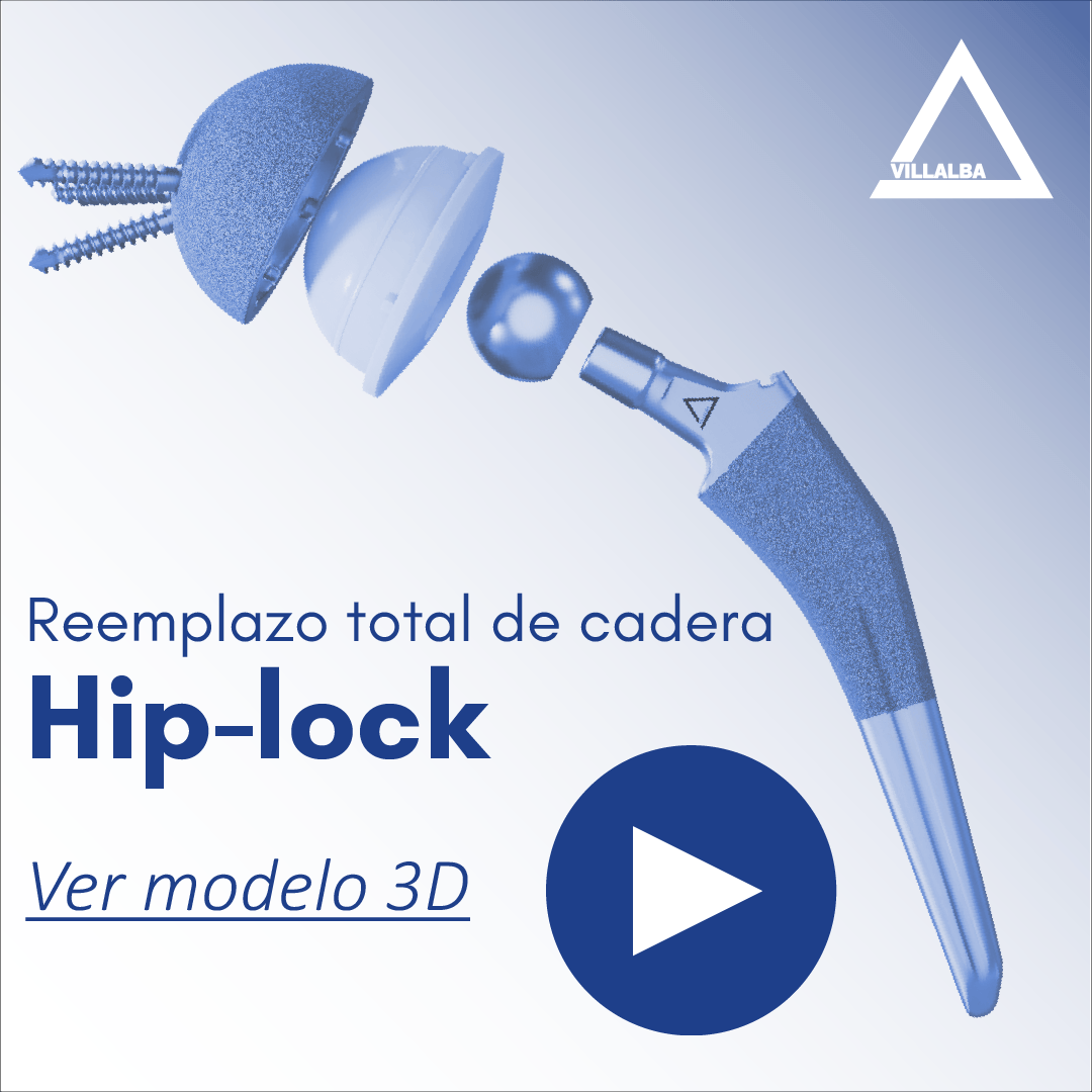 https://implantesvillalba.com.ar/wp-content/uploads/2023/07/2023-Ver-Modelo-3D.png